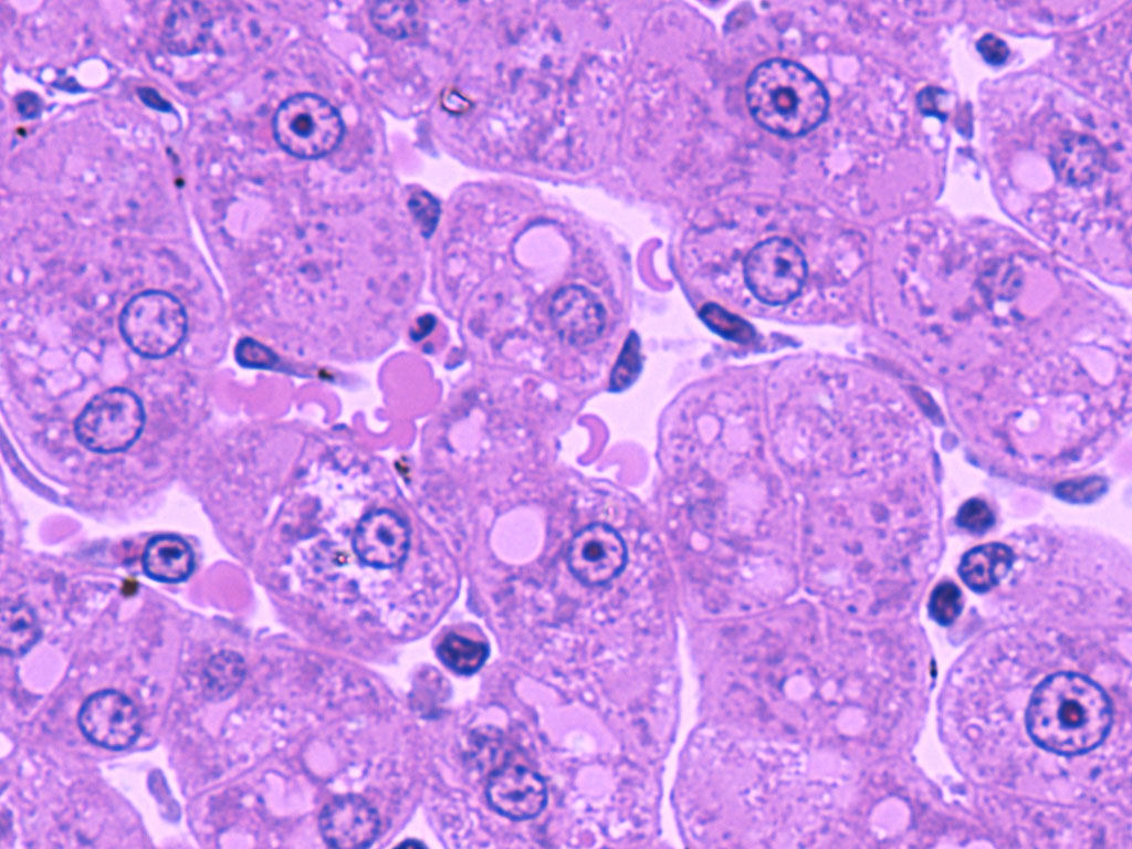 hepatocytes_sinusoids